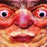 bick