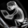 Fetus