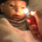 Exeyelius